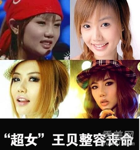 江映蓉整容，江映蓉 鼻子