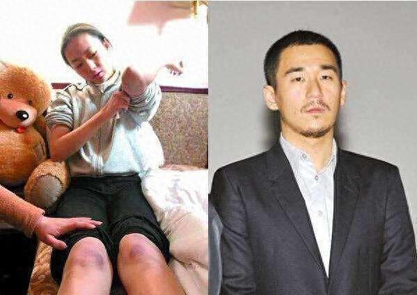 张默为什么动手打女友童谣，多年之后真相公布，网友：刷新三观