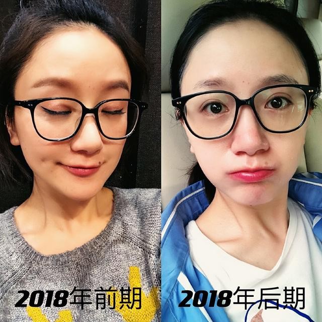 李倩图片个人资料（李倩嘴角的痣对她影响多大）