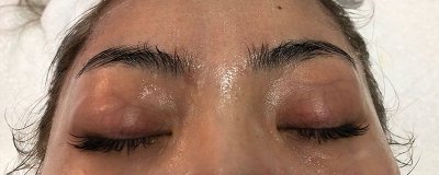 ​纹眉后要涂几天修复液