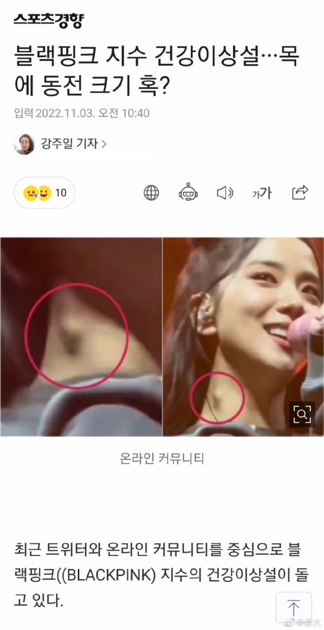 健康着呢!YG否认金智秀患淋巴结肿大 事件回顾