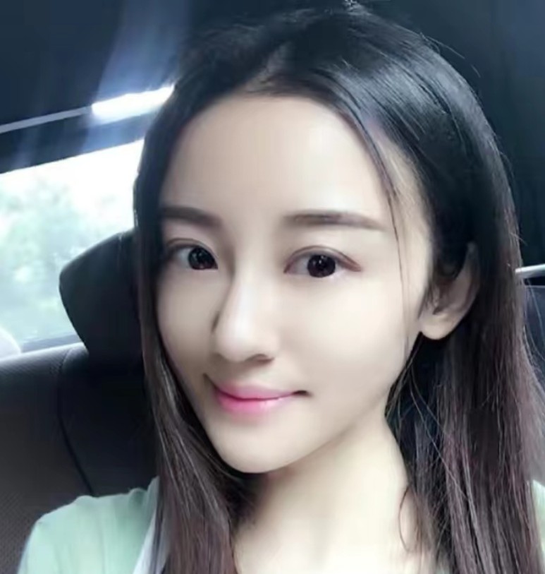 徐婷生前最后一张照片(6年前徐婷患癌全身溃烂离世)