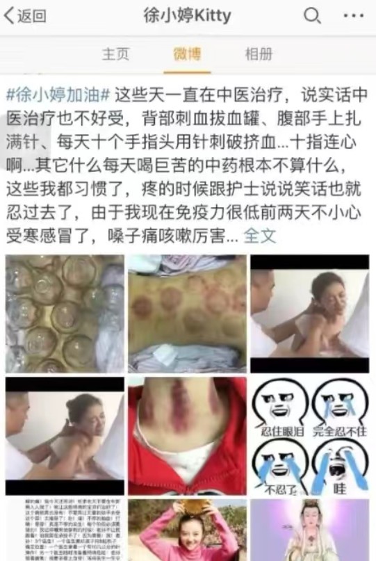 徐婷生前最后一张照片(6年前徐婷患癌全身溃烂离世)