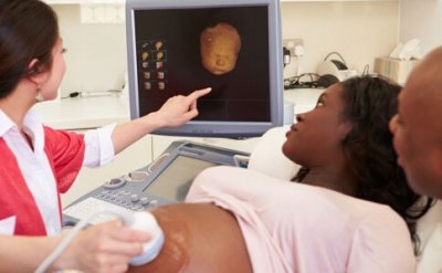 ​怀孕第29周双胞胎B超图