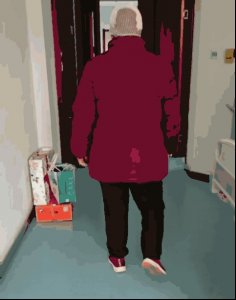 ​南通六院开展机器人辅助DBS手术，为帕金森患者解除多年困扰