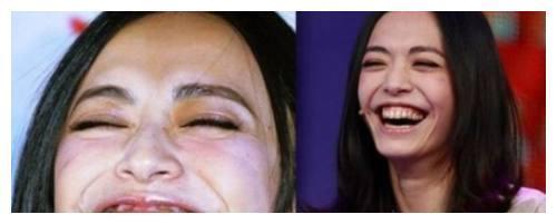 女星好不好看，咧嘴一笑就知道了，郑爽真的好可爱啊！